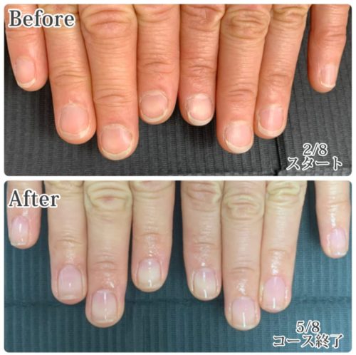 04-4　剥離　育成前・結果